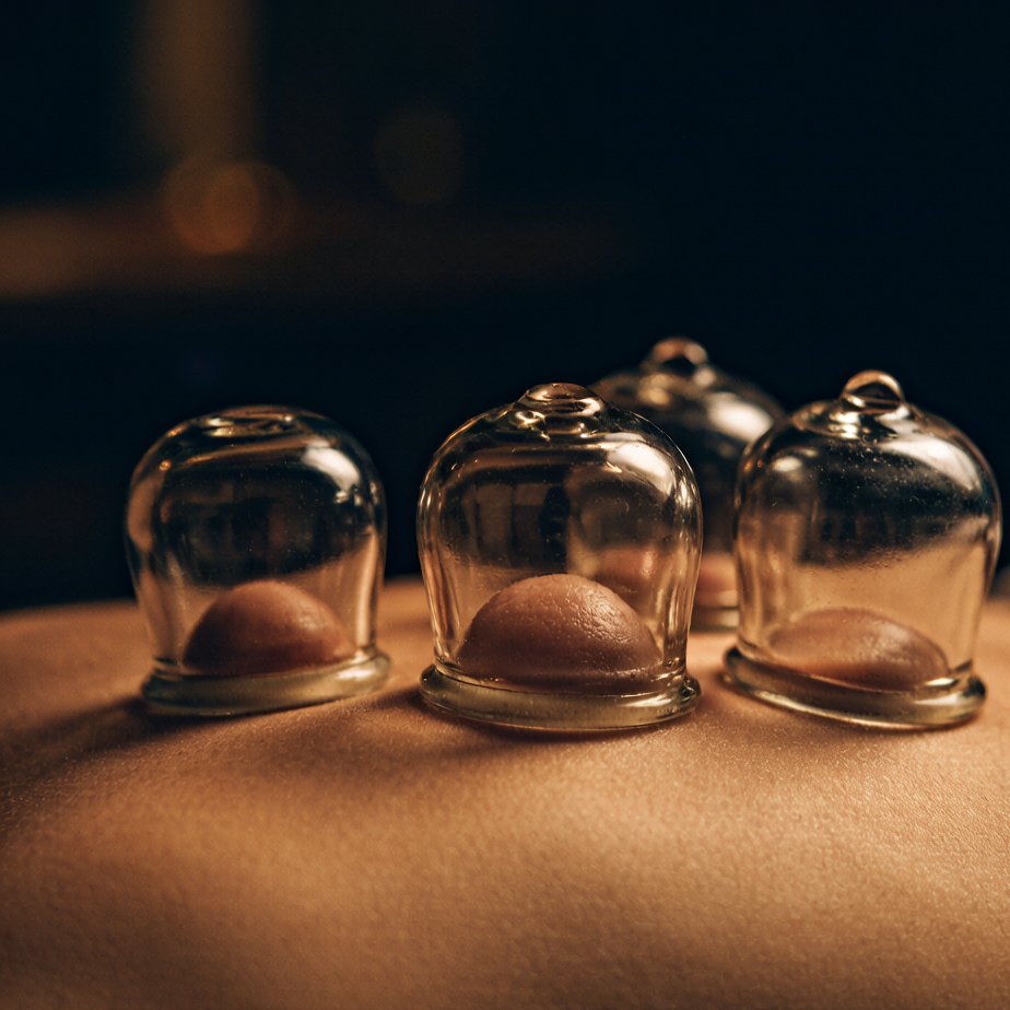 Cupping